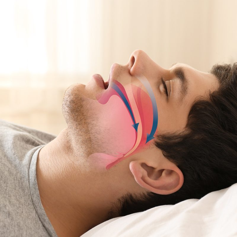 emmanuelle chabrolles grenoble kine maxillo facial apnee du sommeil